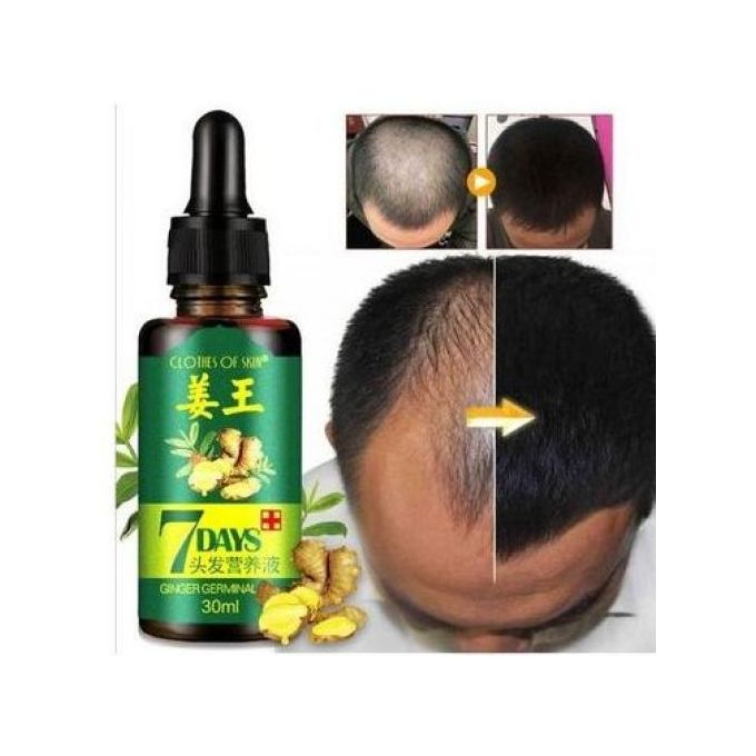Ginger 7 Days Germinal Hair Oil Growth Essence -30ml