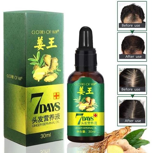 Clothes Of Skin 7 Days Germinal Ginger Oil For Hair Regrowth, Anti-Hairloss
