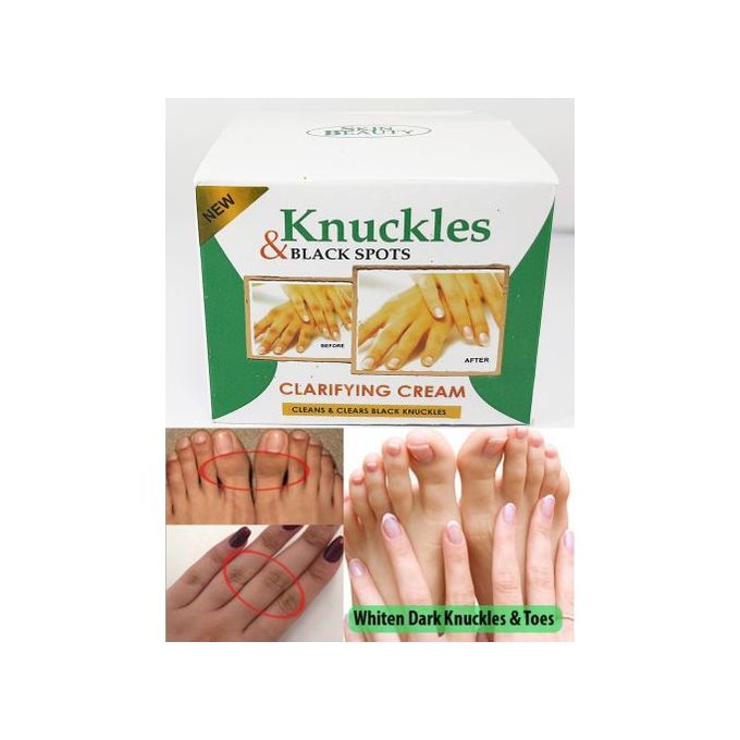Knuckles Elbow Knee Toes Blemish Black Spot Clarifying Cream